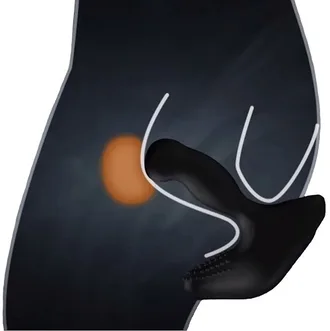 revo 2